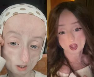 Anja je rođena kao prelepa devojčica, nakon 1. rođendana počinje naglo da stari: Sad ima 17, a zovu je staricom od 80, ostavlja bez teksta načinom života